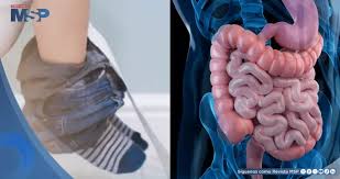 Image result for Encopresis