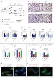 In the lung histology slide, you will find different types of bronchi and bronchiole. Impaired Fetal Lung Development Can Be Rescued By Administration Of Extracellular Vesicles Derived From Amniotic Fluid Stem Cells Biorxiv