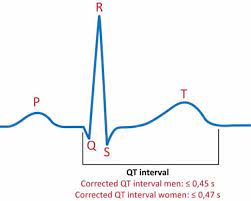 Longt Qt Interval Long Qt Syndrome Lqts Torsades De Pointes Ecg Learning Cardiac Cycle Tricyclic Antidepressant Sodium Channel