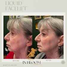 ✨✨💉SMALL BUSINESS SUNDAY💉✨✨ Hi Siloam! My name is Kacie Poole. I am a  Family Nurse Practitioner & proud owner of Illuminate Aesthetics &  Wellness, PLC! I offer a variety of services including