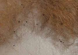 The best flea treatments for cats include flea and tick preventative products like frontline and advantage. What Does A Flea Flea Egg And Flea Larva Look Like