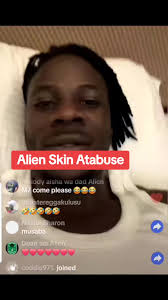 Alien skin atabukidde museveni #fyp #alienskin #uganda