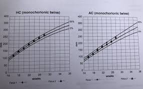 35 Clean Twin Fetal Development Chart