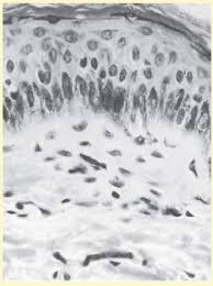 Image result for Oncocalyx bolusii