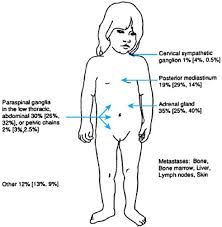 Image result for Primary Tumor Localization