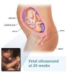 Asked for female, 25 years 2044 views v. Fetal Ultrasound 6 Months Babycentre Uk