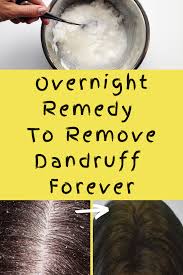 Maybe you would like to learn more about one of these? Best Home Remedy To Remove Dandruff Instantly Home Remedies For Dandruff Remove Dandruff Home Remedies Dandruff Remedy