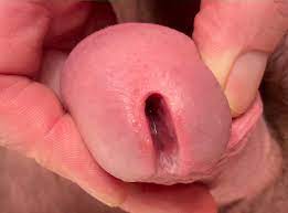 Big penis hole