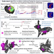 With a simple click you can listen to the best live radio stations from malaysia. Instantaneous Amplitude And Frequency Modulations Detect The Footprint Of Rotational Activity And Reveal Stable Driver Regions As Targets For Persistent Atrial Fibrillation Ablation Circulation Research