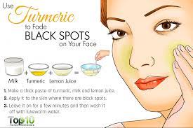 Here's how to get rid of black dots on face fast and naturally using home remedies. Pin On Kerry