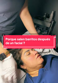 Facial Seguro para Piel Sensible con Rosácea