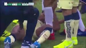 Te deseamos lo mejor en tu próximo reto, siempre serás americanista. Giovani Dos Santos Compartio Mensaje Tras Dura Lesion En El Clasico America Vs Chivas Volvere Pronto Y Mas Fuerte Deporte Total El Comercio Peru