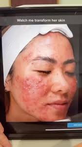 Jim Spivey (@jspivey_aesthetics) · Instagram 照片和视频