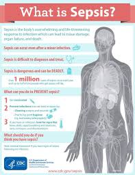 500 000 People Die Each Year From Sepsis Sepsis Medical Knowledge Medical Symptoms