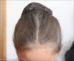 Pin On Amish