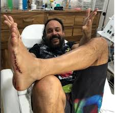 Gabriel O Pensador Sofre Corte Profundo No Pe Surfando No Mexico Surfe Ge