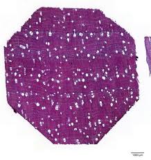 Image result for Dalbergia boehmii