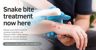 Image result for Snake Bite