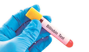We did not find results for: Bilirubin Banyak Dalam Darah