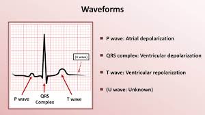 Intro To Ekg Interpretation Waveforms Segments And Intervals Youtube