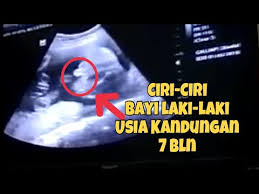 Gambaran usg janin perempuan usia kehamilan 29 minggu 3 hari youtube. Ciri Ciri Bayi Laki Laki Dilihat Dari Usg Umur Kandungan 7 Bulan Youtube