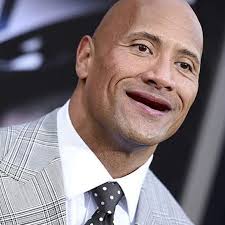 Los chimuelos más famosos del espectáculo