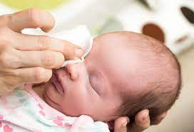 Newborn Sticky Eye Causes Signs Treatment Prevention
