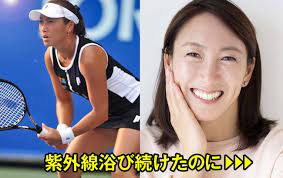 杉山愛 これ使ってます 紫外線を浴び続けた人のシミ対策は説得力抜群 pr メビウス製薬 kagayaki girls シミ 対策 紫外線
