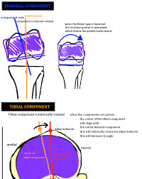Image result for Patella Tracking Assessment