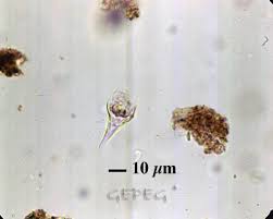 Image result for Psilotrichum sericeum