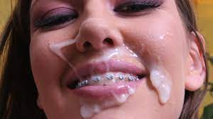 Braces are beautiful - CUM FACE BITCHES ONLY | MOTHERLESS.COM ™