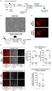 Here you will find a warm, inviting office filled with state of the art technology, friendly faces and the. Frontiers Radiation Induced Metabolic Alterations Associate With Tumor Aggressiveness And Poor Outcome In Glioblastoma Oncology