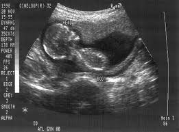 What does a faint line on a pregnancy test pregnancy tests are designed to show if your urine contains a hormone called human chorionic sometimes, it also works a few days before the period due date. The History Of Fetal Ultrasound Pregnancy Imaging Live Science