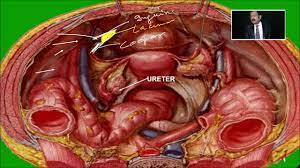 Pelvic diaphragm, inferior view (gilroy et al.) atlas of anatomy 2nd ed., fig. Laparoscopic Anatomy Of Pelvis By Dr R K Mishra Youtube