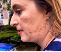 Why was fundraiser a disaster despite success?