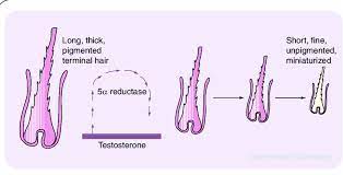 At the point when your body connects with ru58841, it delivers a compound known as cyanonilutamide, which has i have helped many to stop hair loss and regrow hair. Pathogenesis Of Androgenetic Alopecia Involves Androgen Mediated Hair Download Scientific Diagram