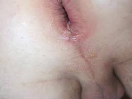 Résultat de recherche d'images pour "gay porn pulsating gay anus"