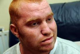 Shaun vows to keep fighting