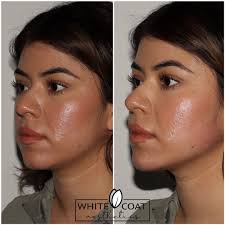 Amanda Ralph, APRN, MSN, NP-C