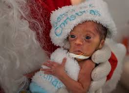 Santa visits babies at Helen DeVos Children's Hospital NICU