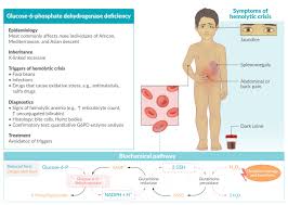 Image result for G6PD Deficiency