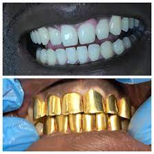 Check spelling or type a new query. Orange Mound Gold Teeth Home Facebook