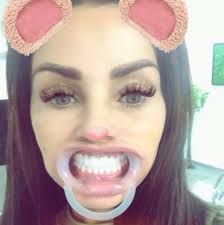 Katie price has reportedly been left 'horrified' after her brand new veneers fell out revealing huge gaps in her smile. Katie Price Unveils Dramatically Different Teeth After Old Veneers Led To Horrific Medical Emergency Irish Mirror Online