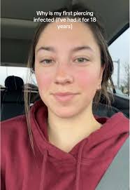 Dealing with Piercing Infections: Personal Experience