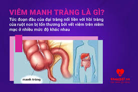 Một bé gái 13 tháng tuổi tên kiki được đưa đến cấp cứu tại bệnh viện nhi đồng yuying trực thuộc đại học y (trung quốc). Viem Manh Trang La Gi Theo Doi PhÆ°Æ¡ng Phap Ä'iá»u Trá» Hiá»n Nay