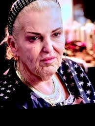 As a pretty fit woman in her 70s, Deborah maintained an active lifestyle  and was always confident in her appearance. She kept up with her skin care  and loved to get facials,