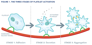 Image result for Platelet Dysfunction