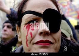 Le manifestant de Yellow Vest porte un logo sur les yeux, représentant le  chef du mouvement français de la veste June Jerome Rodrigues, blessé aux  yeux par la police française , en