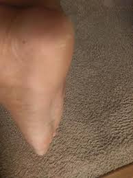 Most people start seeing results in only a couple days. O Keefe S Healthy Feet Night Treatment Foot Cream 3 Oz City Market