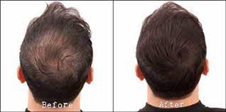 Hair thickening products are the secret to big, bold hair. 3x Hairz Hair Loss Concealer Fuller Building Fiber Powder For Men Women Ebay